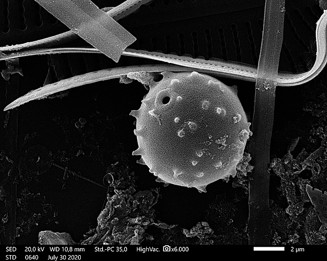 Cistos de algas y diatomeas, bajo el microscopio electrónico de barrido.