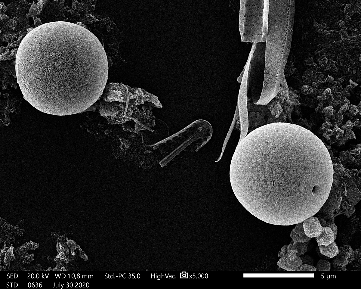 Cistos de algas microscópicas de unas seis micras (milésimas de milímetro) de diámetro, bajo el ojo electrónico del microscopio de barrido. | ANA ISABEL NEGRO