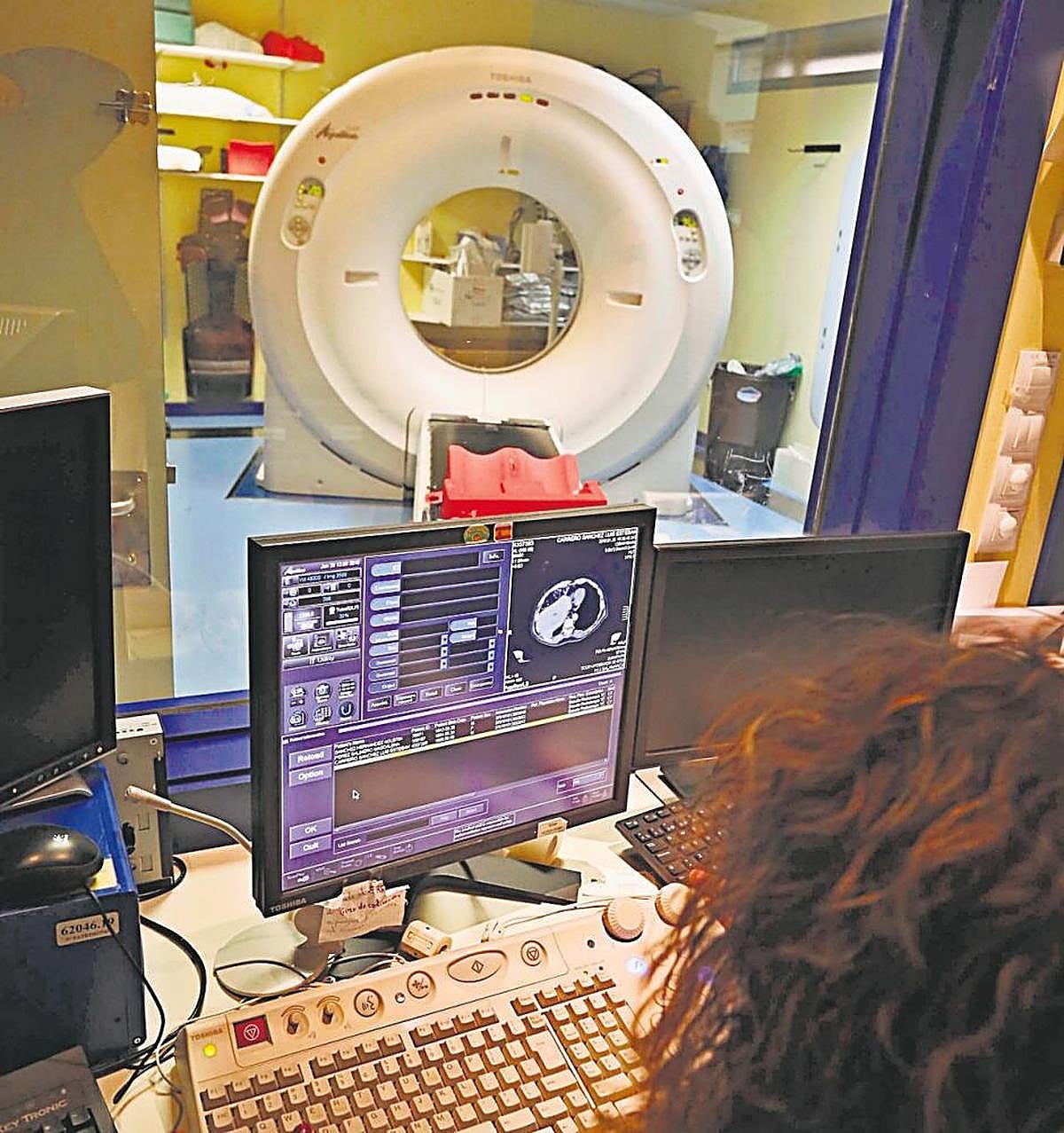 Imagen del PET-TAC que había en el Hospital Clínico de Salamanca.