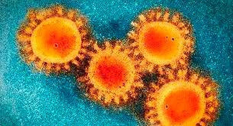 La COVID-19 a través del microscopio