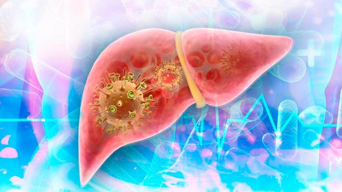 Ilustración de un virus de hepatitis en un hígado.