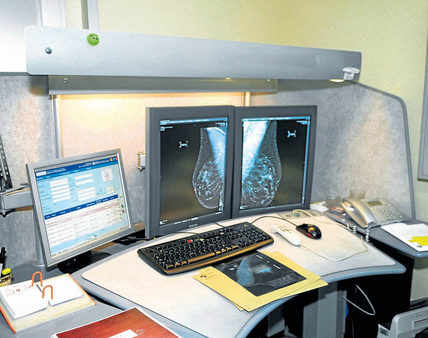 La espera para una mamografía en el Hospital se dispara a casi 4 meses
