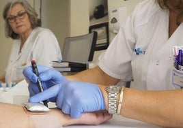 Una paciente se somete a un test de alergia al frío en el Hospital de Salamanca.