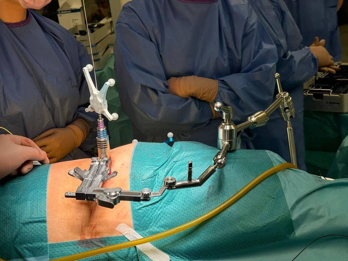 Imagen secundaria 1 - El Hospital da un &#039;giro&#039; a la cirugía de columna y la opera por el abdomen