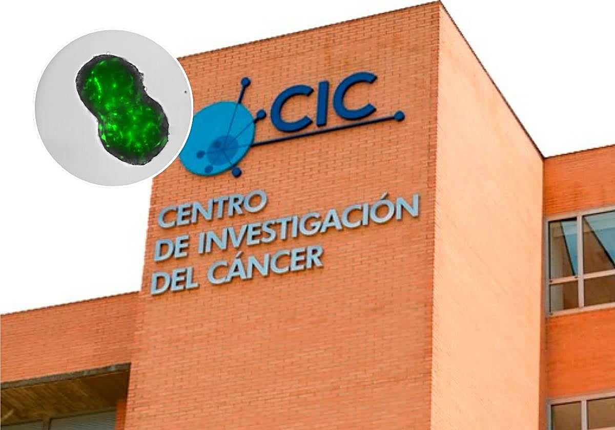 Un avance internacional liderado por el Centro de Investigación del Cáncer abre nuevas vías terapéuticas para el colangiocarcinoma