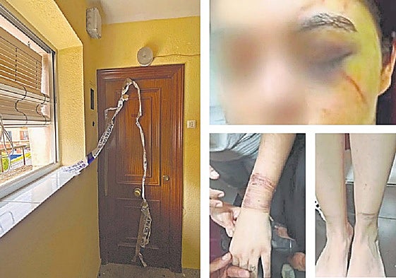La puerta de 'la casa de los horrores', en el barrio del Carmen, y lesiones de la víctima en ojo, muñecas y tobillo.