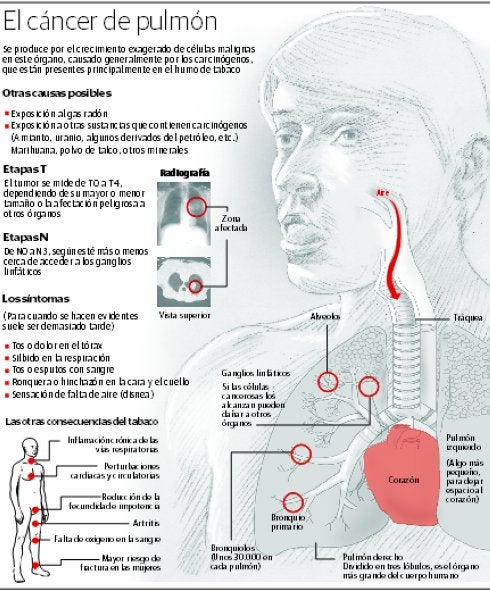 La primera causa de defunción entre los hombres riojanos