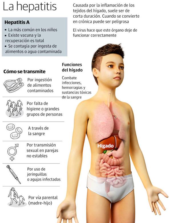 La hepatitis A toma impulso