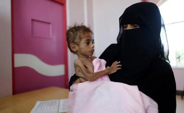 Una madre yemení sostiene a su hijo malnutrido en un hospital de Sanaa.
