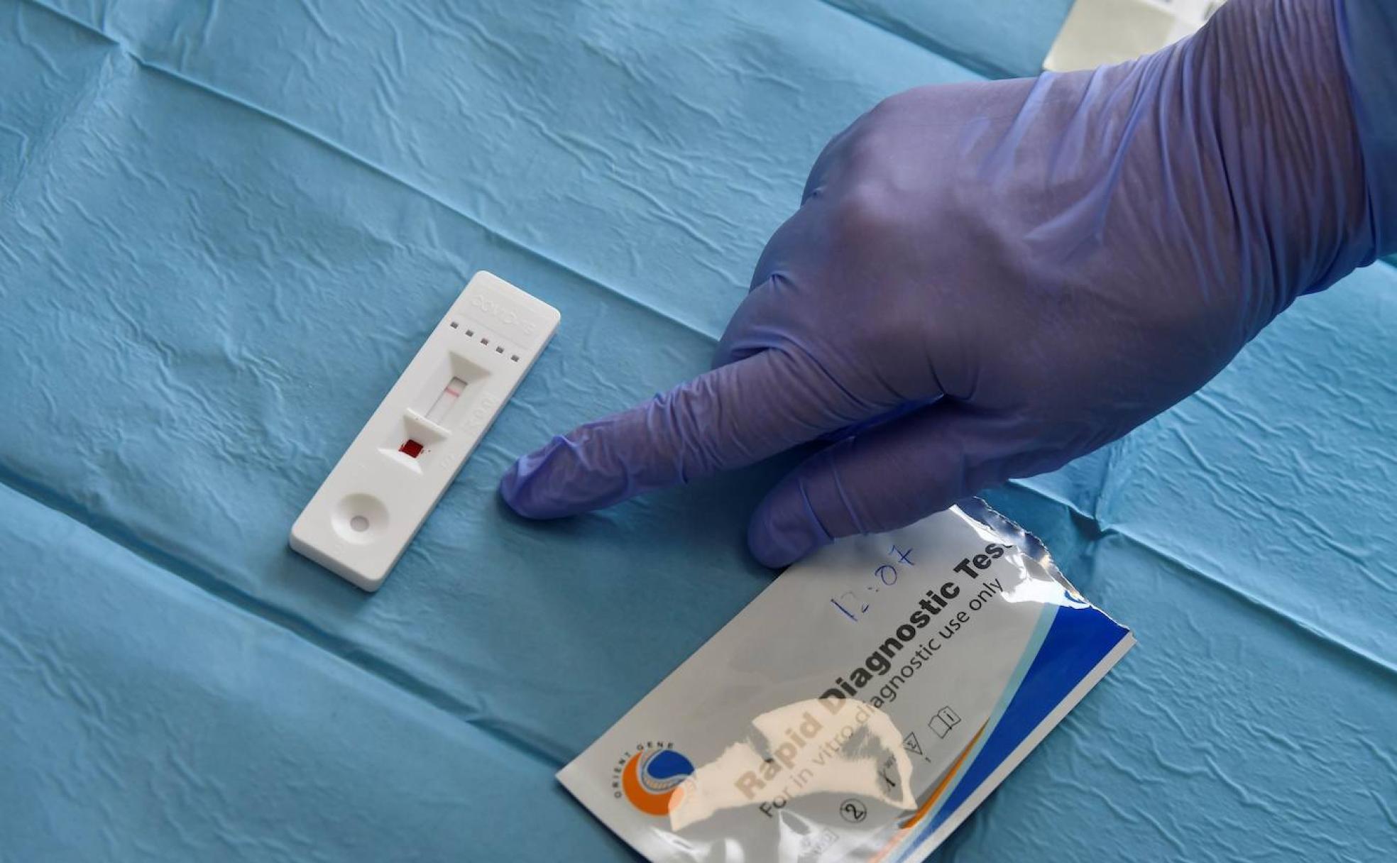 Solo el 3,3% de los riojanos tiene anticuerpos contra el coronavirus