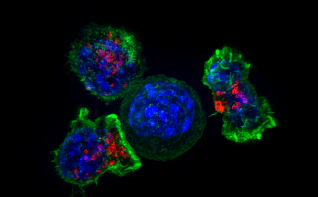 Células del sistema inmunitario (linfocitos T citotóxicos) rodean una célula cancerosa. 