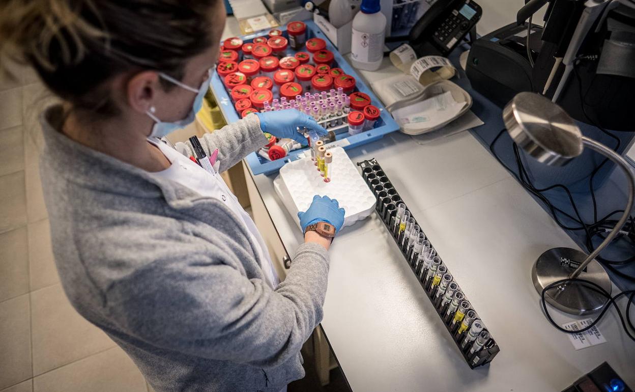 Investigación sobre el COVID en el laboratorio del hospital San Pedro. 