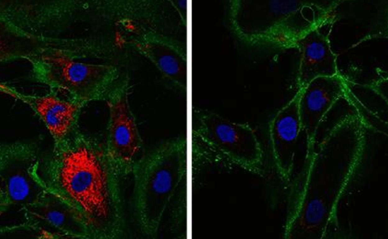 Científicos de Cambridge rejuvenecen la piel de una mujer