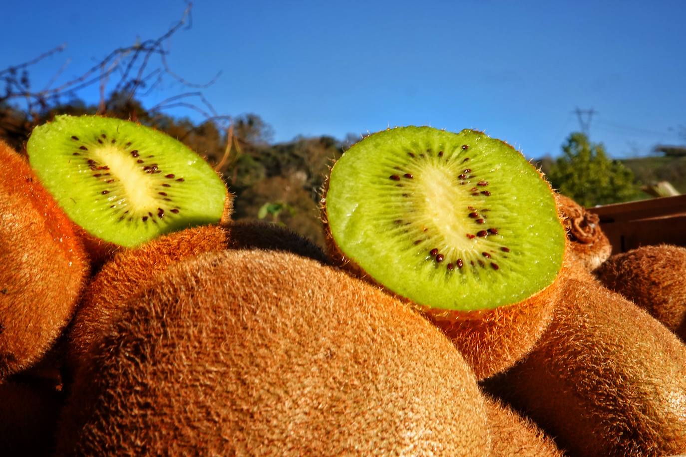 El kiwi es el aliado perfecto para combatir el estreñimiento