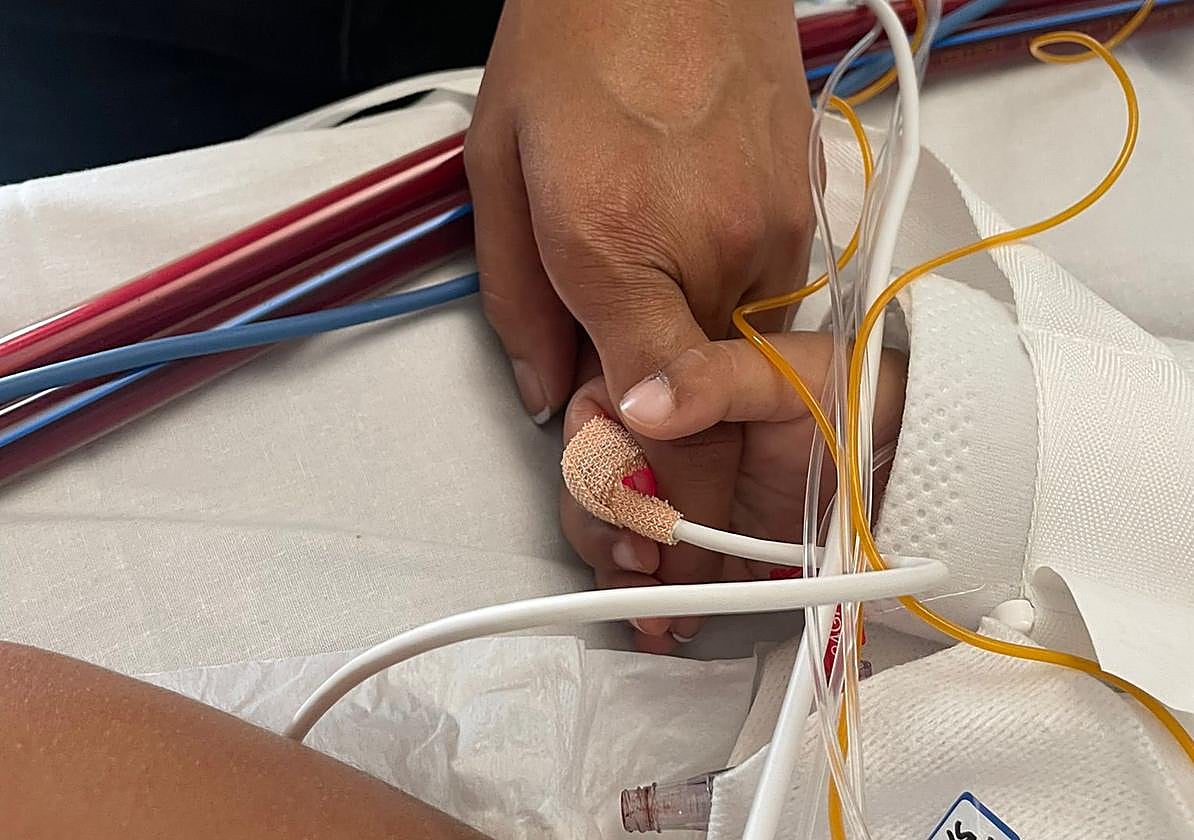 Un pulmón artificial y la coordinación de decenas de profesionales salvan la vida de un niño jarrero a punto de morir por culpa de un cacahuete.