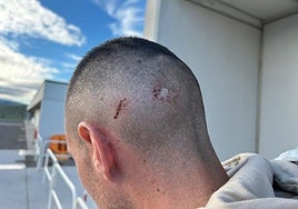 Kike Royo muestra las consecuencias del golpe sufrido en el partido copero.