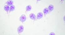 Giardiasis
