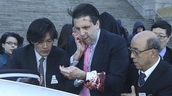 El embajador de Estados Unidos en Corea del Sur, Mark Lippert. 