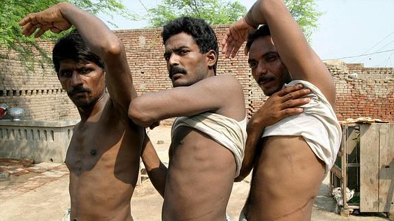Víctimas paquistaníes de tráfico de órganos.