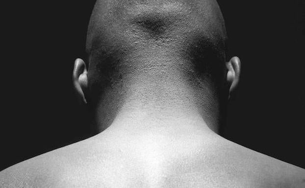 El esguince cervical afecta a más de 25.000 españoles cada año. 