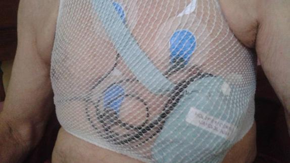 Paciente con un holter cardiaco. 