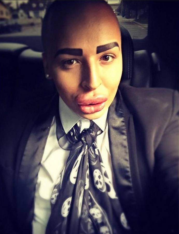 Se gasta 121.000 euros para parecerse a Kim Kardashian