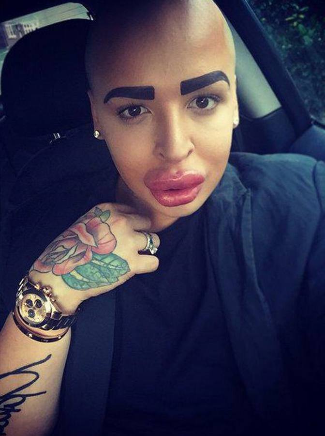 Se gasta 121.000 euros para parecerse a Kim Kardashian