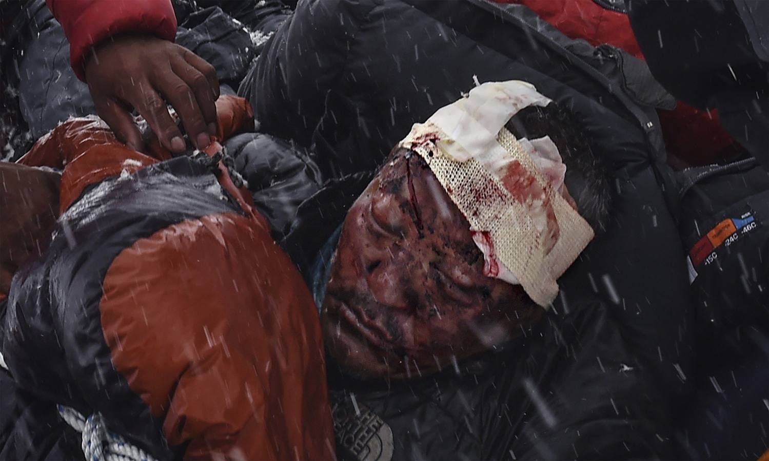 Fotografía de la serie ganadora del segundo premio en "Historias" de la categoría de Deportes, tomada por el fotógrafo colombiano Roberto Schmidt. La fotografía muestra a un hombre gravemente herido que es llevado por un grupo de sherpas al campamento base para que reciba atención médica tras sobrevivir al desprendimiento de roca, hielo y nieve que acabó con la vida de más de 22 personas en el Everest, en el Himalaya, el 25 de abril 2015.