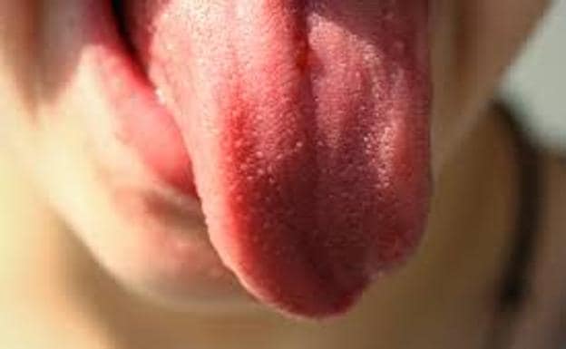 Las alteraciones en la lengua o boca pueden causar sensación de 'sabor a metal'.