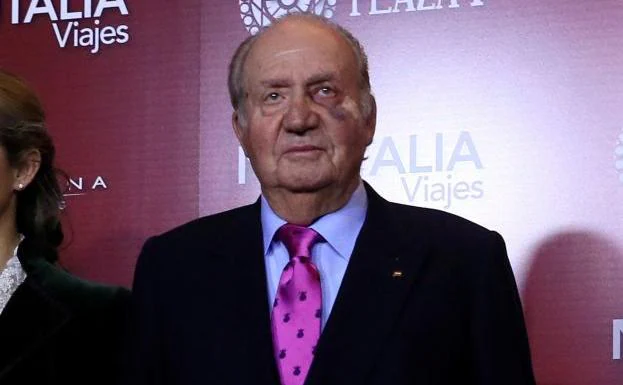 El rey Juan Carlos, con un moratón y el apósito debajo del ojo.