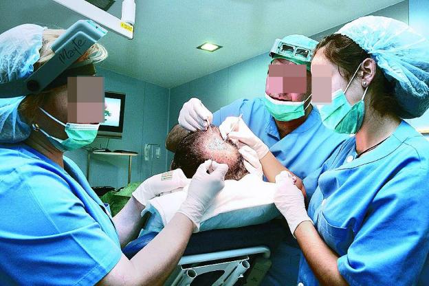 Operación de implantes capilares. 