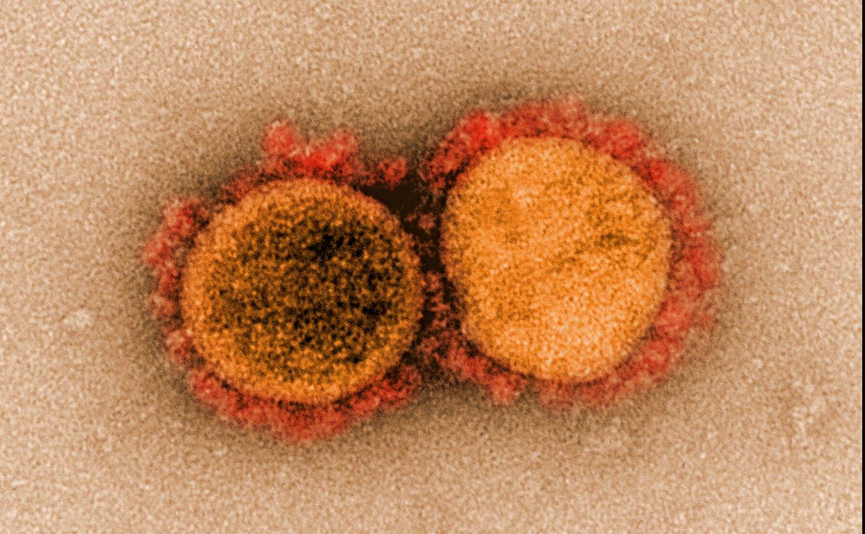 Imagen del coronavirus SARS-CoV-2 tomada con microscopio. 