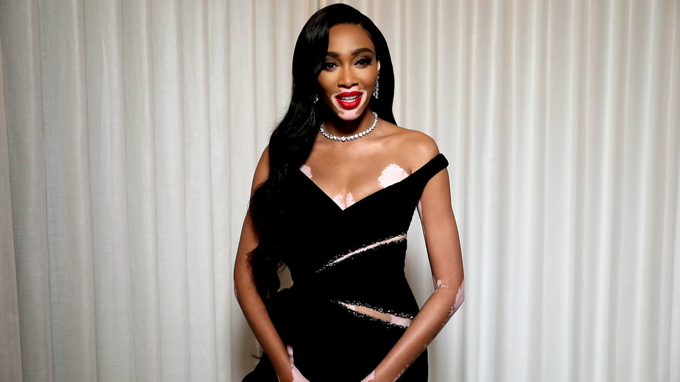 Winnie Harlow 