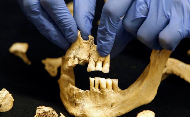 Detalle de la mandíbula del caballero ajusticiado de la segunda mitad del siglo XIV.
