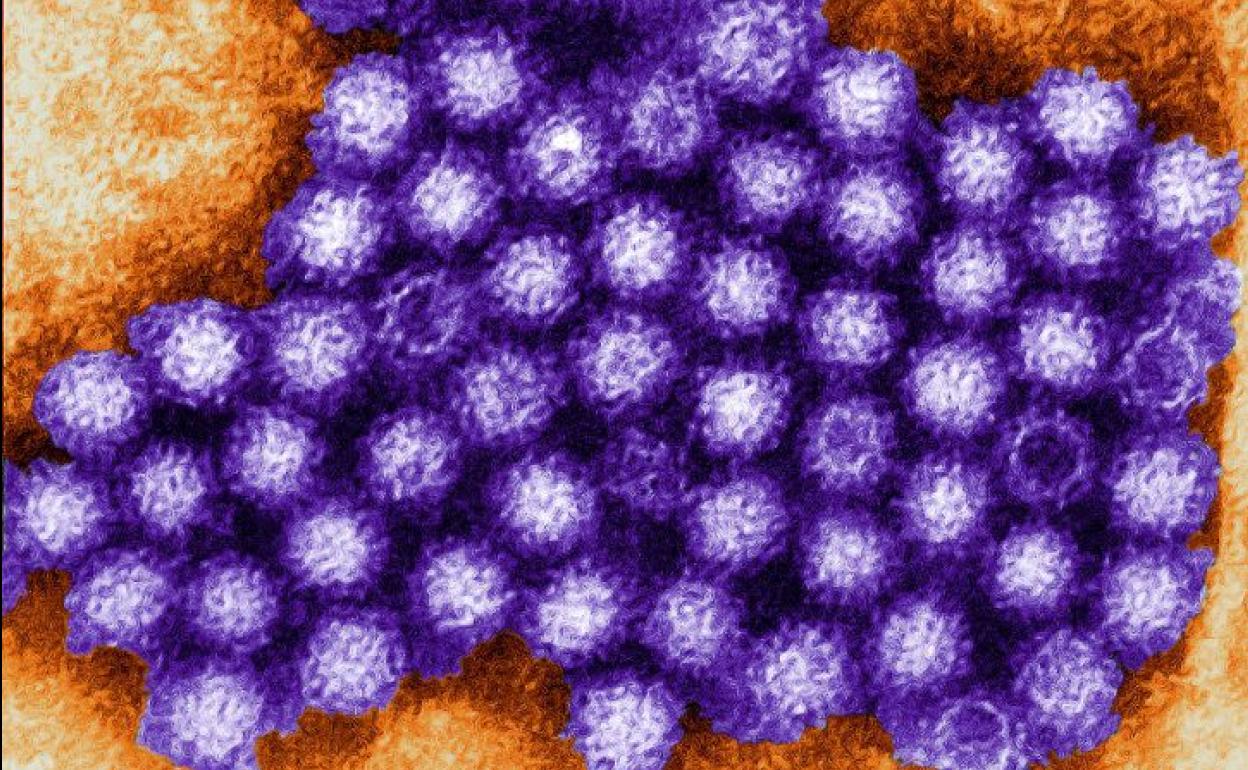 El norovirus bajo el microscopio.