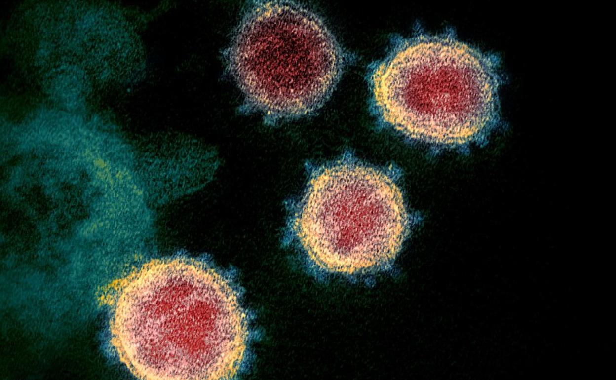 El virus SARS-CoV-2 bajo el microscopio.