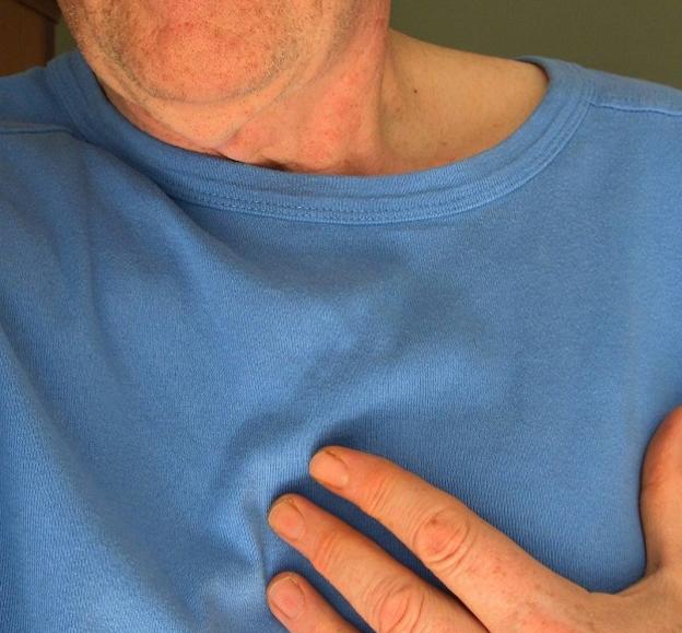 La fibrilación auricular. Qué es y cómo tratarla.