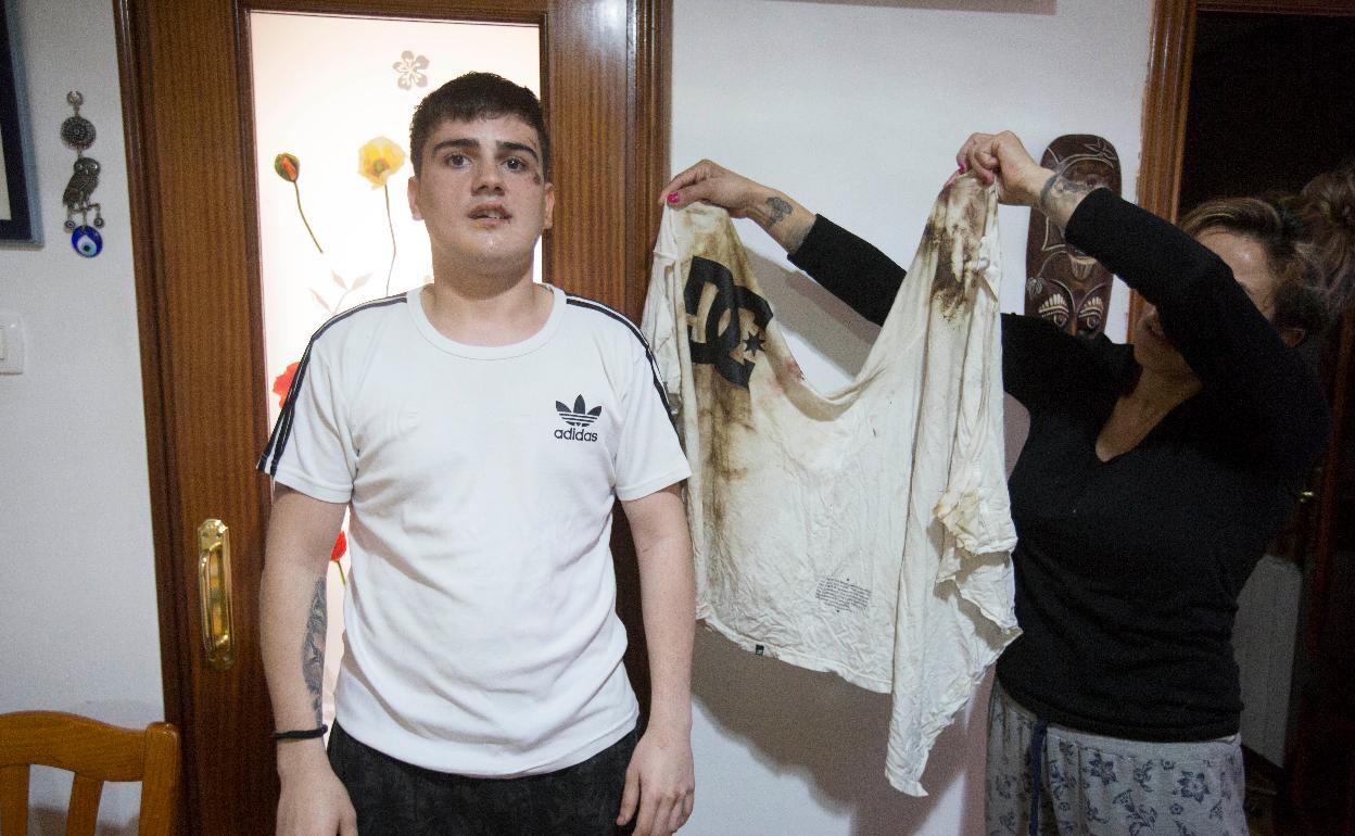 El joven Adrián, con el rostro destrozado a golpes. Su madre muestra la camiseta ensangrentada. 