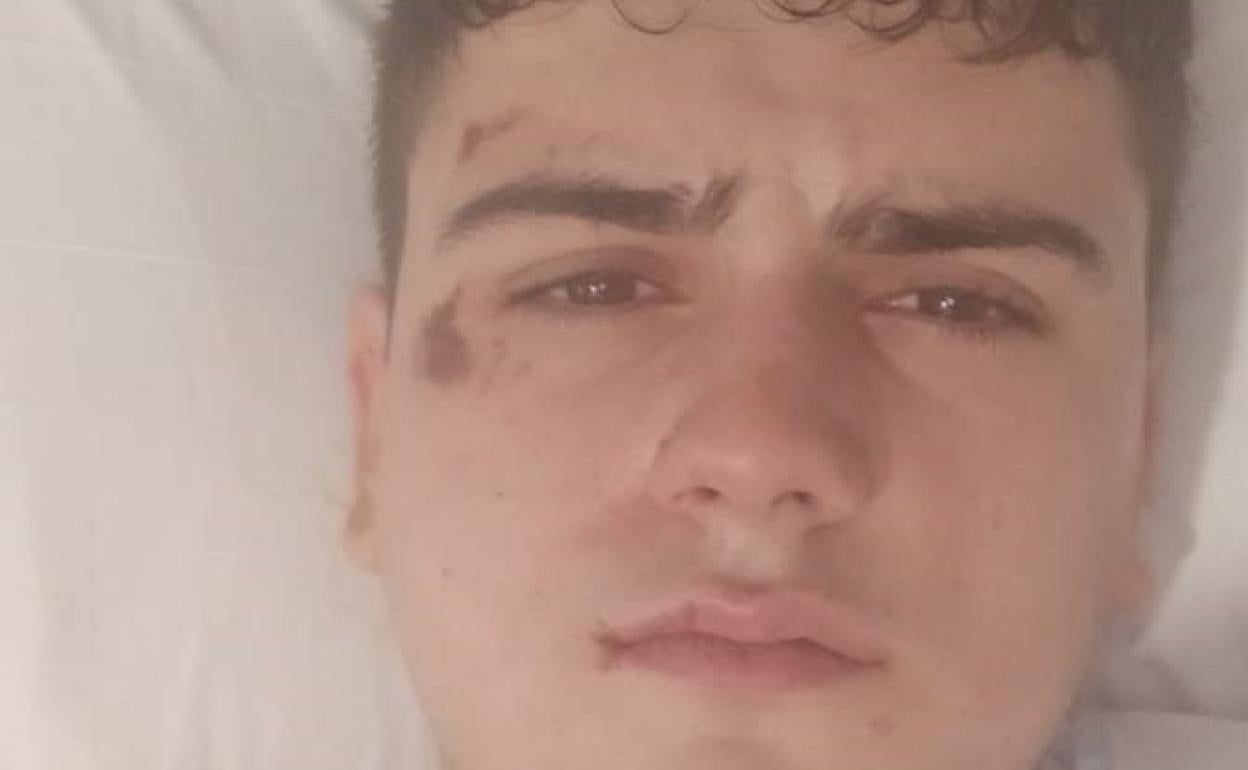 El joven Adrián, con el rostro destrozado por los golpes, en la imagen difundida por Nuria para concienciar sobre la gravedad de la paliza. 