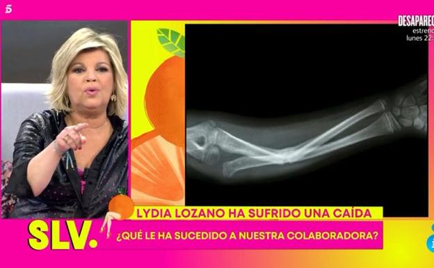 Radiografía del brazo de Lydia Lozano.