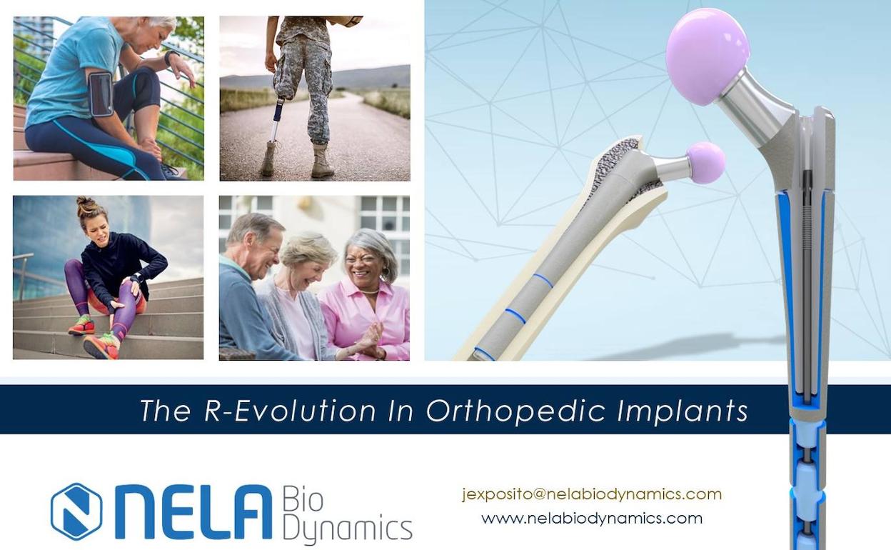 Prótesis desarrolladas por Nela BioDynamics. 
