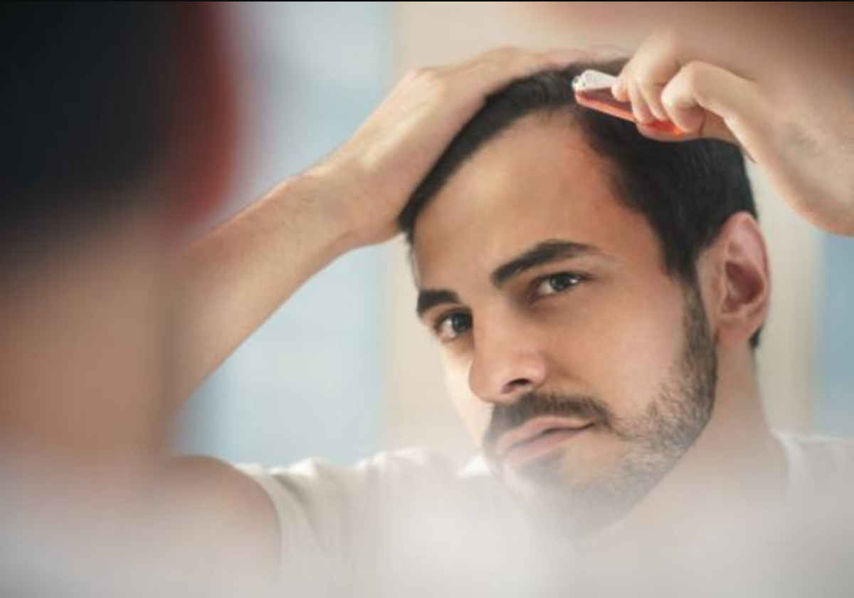 Cuántos pelos es normal que se caigan al día y cuáles son las causas más comunes de la alopecia