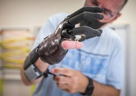 Un hombre prueba el funcionamiento de su mano robótica tras una amputación, en una imagen de archivo.