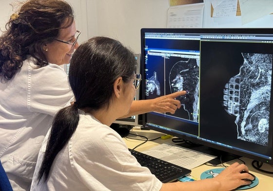 Utilización de la resonancia magnética en cáncer de mama.