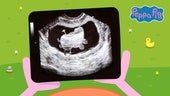 La primera ecografía del nuevo hermanito de Peppa Pig