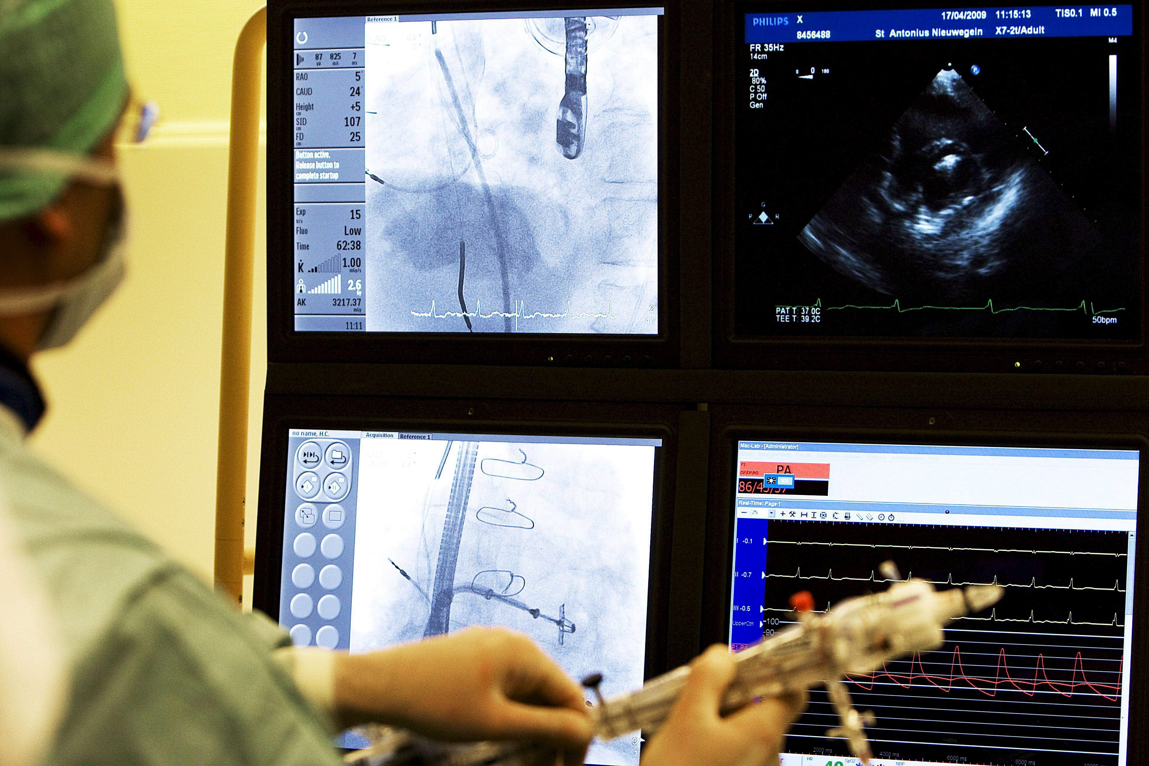 Los cardiólogos alertan a las mujeres sobre el síndrome CKM y les pide conocerlo para poder vivir más y mejor