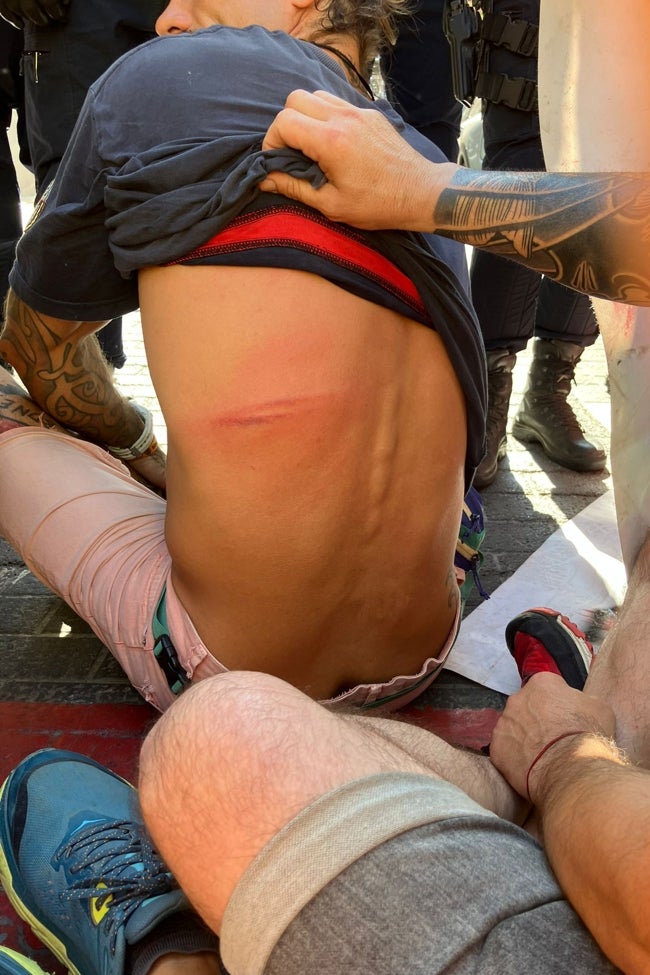 Uno de los manifestantes herido.