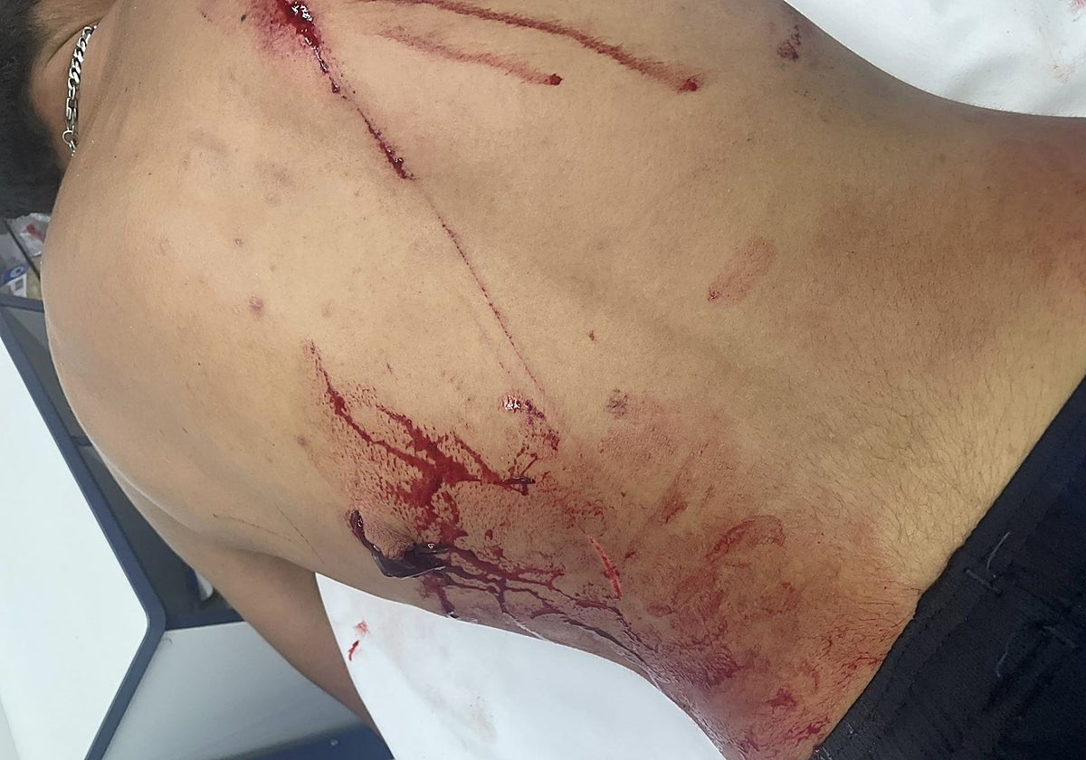 Herido en una reyerta en la plaza Tribunal de les Aigües de Valencia.