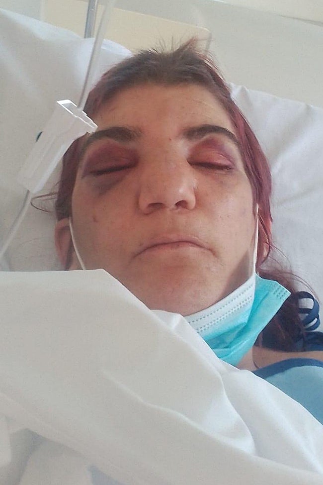 La víctima en el hospital tras ser rescatada por la Policía Local de Valencia.