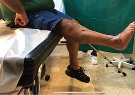 El paciente al que Cavadas ha operado.